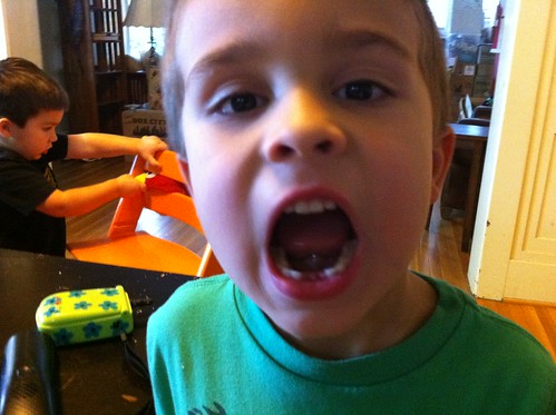 Second tooth: gone
