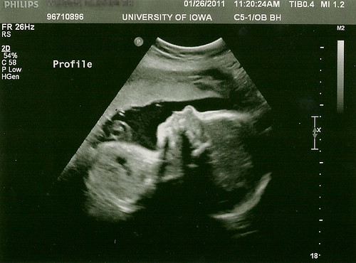 29 week ultrasound