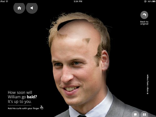 is prince william bald. Prince William bald and