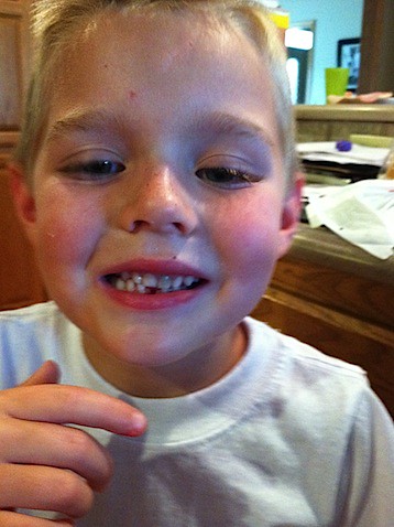 Owen's tooth 3.jpg