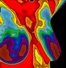 breast_thermography