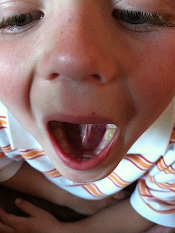Owen opens wide tooth photo