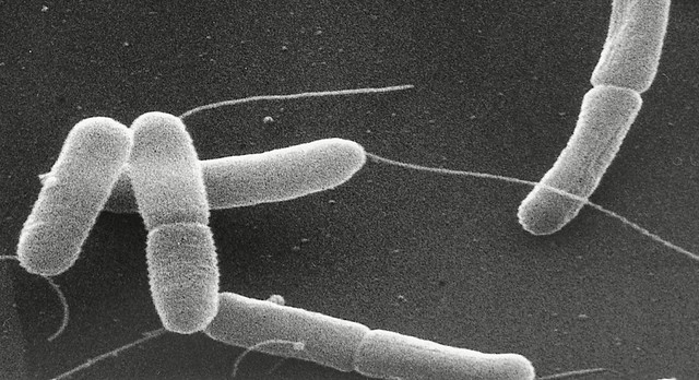 Escherichia coli (bactéria E. coli) vista sob o microscópio eletrônico