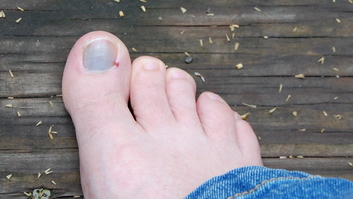 Why Toe-Punching a Soccer Ball is Not a Good Idea...