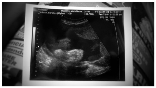 No wonder im in so much pain and so huge. 34 w bb is measuring 37 weeks. Weighs 7lbs 9 oz!!!!!