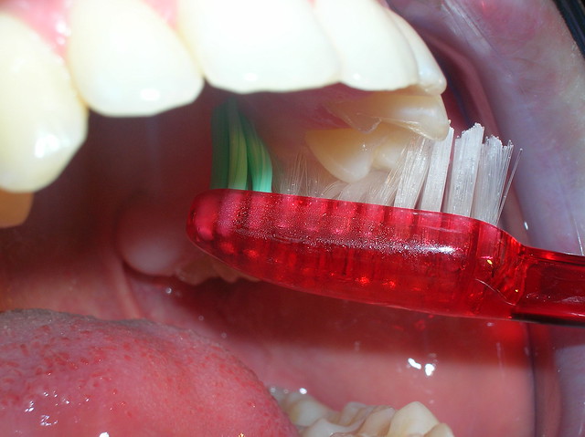 Zona palatina, molares