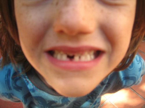 LOST MY FIRST BABY TOOTH