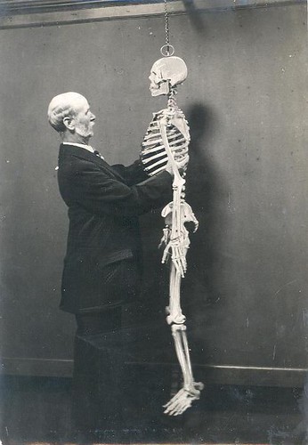 Skeleton by TWAM - Tyne & Wear Archives & Museums