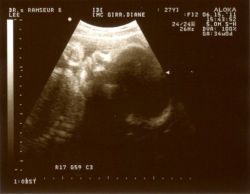 34week-ultrasound1