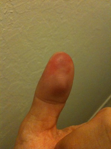 Puck hit my left thumb in the game... swollen and hurting