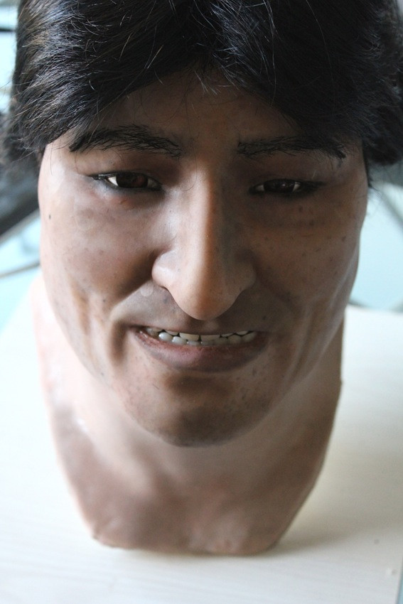 head of Evo Morales in Silicone hair implants