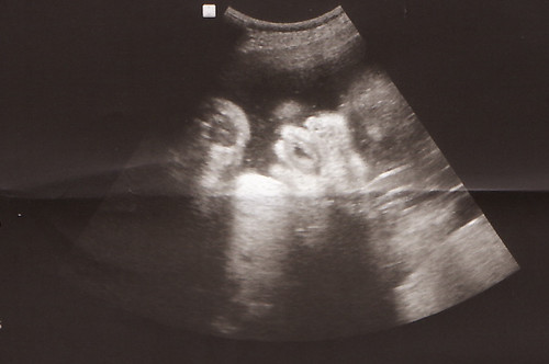 ultrasound 35 weeks-face.jpg