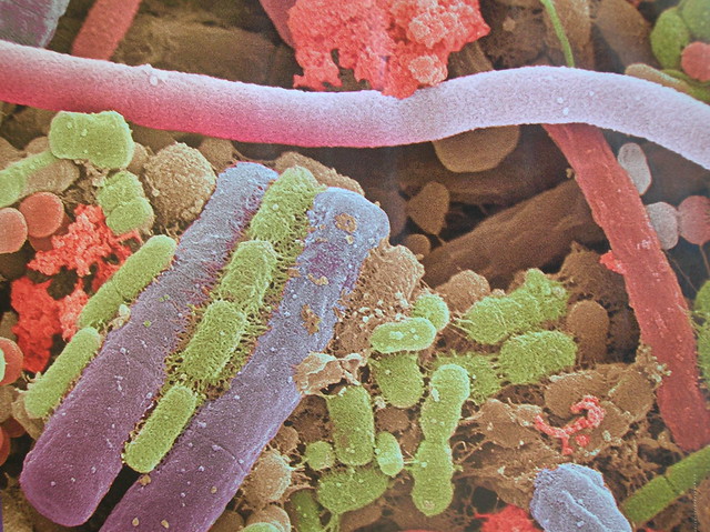 Bacterias de la placa dental