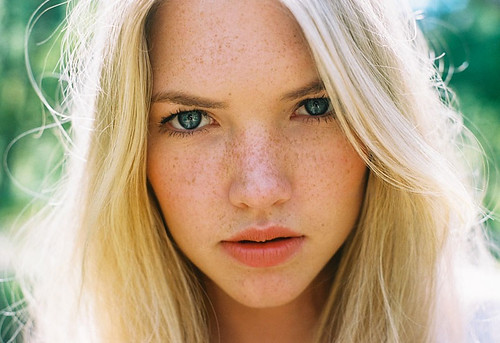 Girls with freckles