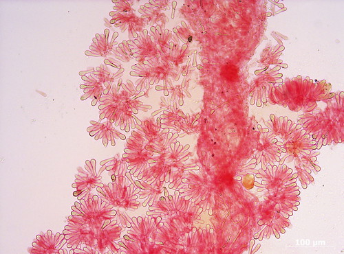 Amanita phalloides basidia by ressaure