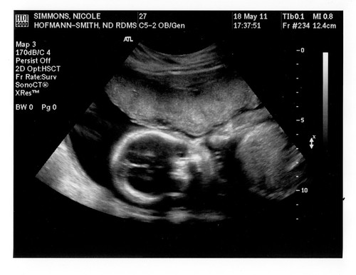 23 week ultrasound