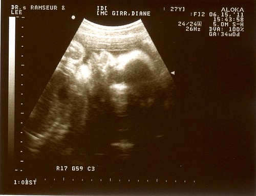 34week-ultrasound2