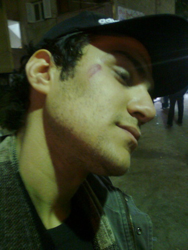 اصابات بين المتظاهرين بالمنصوره فى يوم الغضب 25 يناير