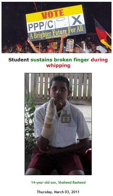Student sustains broken finger during whipping