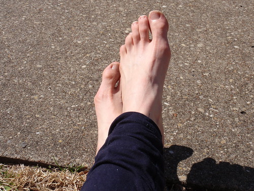 Post-run Feet