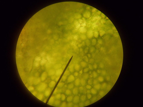 duckweed cells