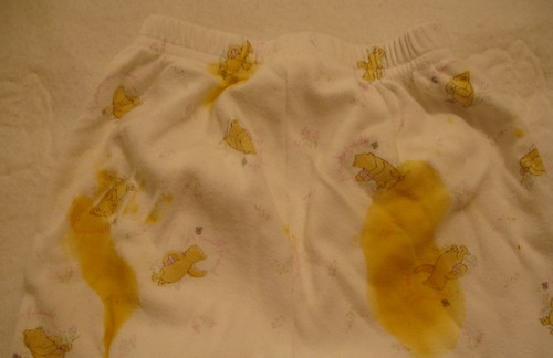 Baby Poop on Pants