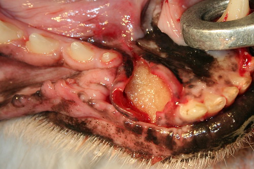 Lower Canine Extraction