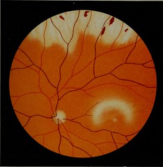 Anglų lietuvių žodynas. Žodis retinal rod reiškia tinklainės lazdele lietuviškai.