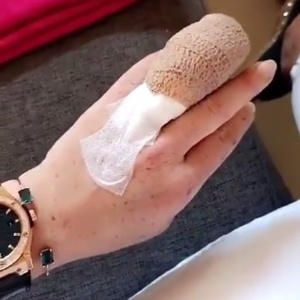 Lindsay Lohan passa por cirurgia na mão após acidente de barco