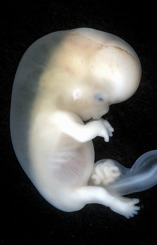 Embryo approximately 8-10th week from conception